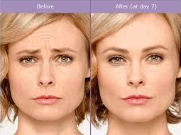 Skin-Secrets-Services-Physician-Example