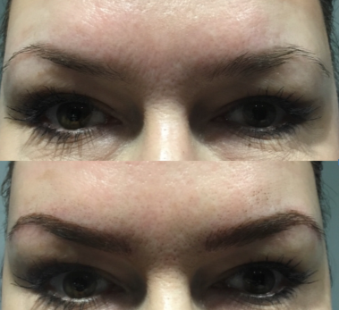 microblading 1